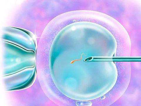 日喀则地卵巢早衰可以借卵怀孕吗_试管婴儿术前检查项目 精索静脉曲张如何有