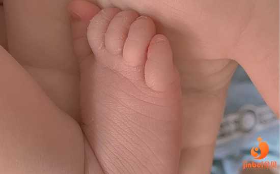 思茅借卵泡做试管婴儿流程_时光荏苒，41年前世界首个试管婴儿路易丝·布朗已