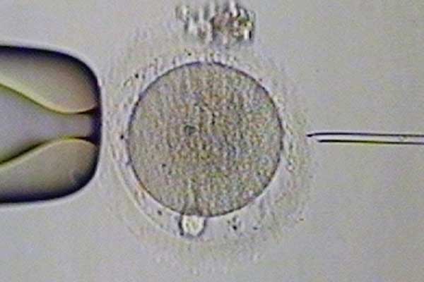 房山42岁供卵试管案例_俄罗斯试管婴儿基因检测对囊胚会有伤害吗？
